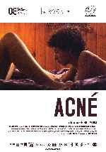 miniatura acne-por-peppito cover carteles