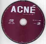 miniatura acne-region-1-4-por-jaboran333 cover cd