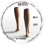 miniatura autopsy-custom-por-husci cover cd