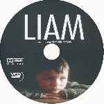miniatura liam-custom-por-alison cover cd