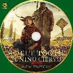 miniatura sweet-tooth-el-nino-ciervo-custom-por-chechelin cover cd