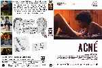 miniatura acne-custom-por-matojin cover dvd