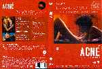 miniatura acne-region-4-por-argento1971 cover dvd