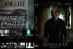 miniatura anomalous-custom-por-pmc07 cover dvd