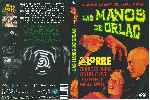 miniatura las-manos-de-orlac-1935-por-joseluis17 cover dvd