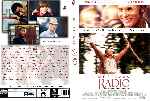 miniatura me-llaman-radio-custom-por-el-verderol cover dvd