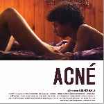 miniatura acne-por-jrc cover divx
