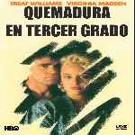 miniatura quemadura-en-tercer-grado-por-chechelin cover divx