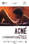 Acné