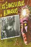 Las sanguijuelas humanas
