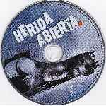 carátula bluray de Herida Abierta - Disco