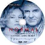 carátula cd de Normal - Custom