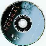 carátula cd de Normal