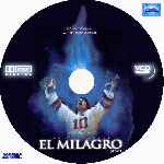 carátula cd de El Milagro - Miracle - Custom