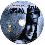 carátula cd de Herida Abierta
