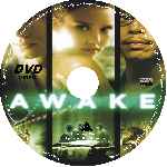 carátula cd de Awake - Custom