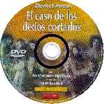 carátula cd de Sherlock Holmes - El Caso De Los Dedos Cortados - Hollywood Classics