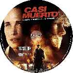 carátula cd de Casi Muerto - Custom