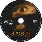 carátula cd de La Masacre De Toolbox