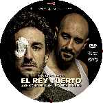 carátula cd de El Rey Tuerto - Custom