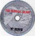 carátula cd de The Normal Heart 