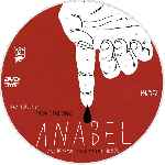 carátula cd de Anabel - Custom