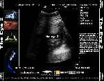 carátula trasera de divx de The Eye 2 - V2