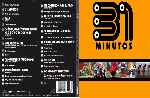 carátula dvd de 31 Minutos - Custom
