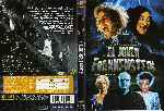 cartula dvd de El Joven Frankenstein - Region 1-4