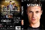 carátula dvd de Mental - Temporada 01 - Custom
